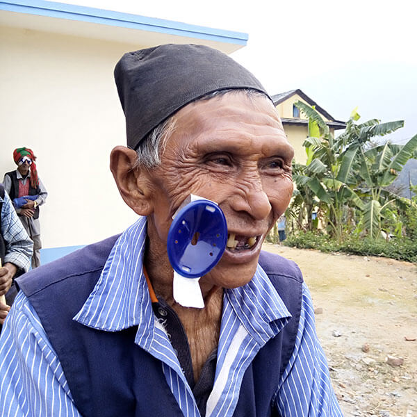 blindness in Nepal